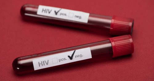 Jak można zarazić się HIV? Poznaj najczęstsze drogi zakażenia