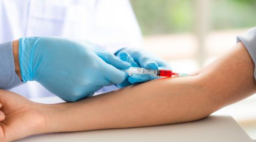 Podstawowe badania krwi – jakie warto robić regularnie? Sprawdź, jakie choroby mogą wykryć