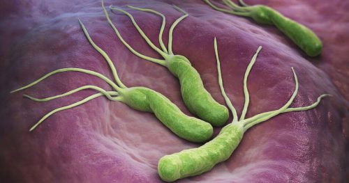 Helicobacter pylori – jakie dolegliwości i choroby wywołuje ta bakteria?