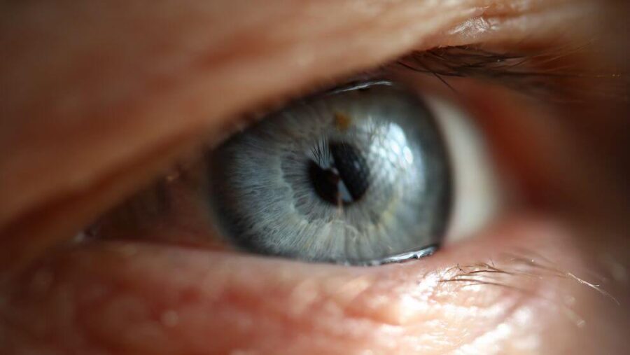 Zaćma – jakie są przyczyny i dostępne metody leczenia katarakty ocznej?