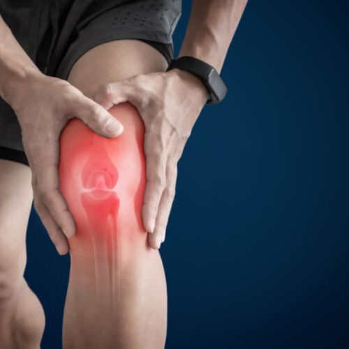 Doskwiera Ci ból kolana? To może być uszkodzenie łąkotki przyśrodkowej lub bocznej