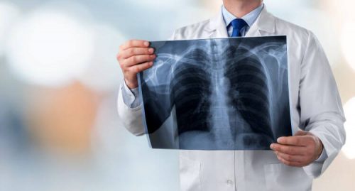 Obrzęk płuc – czym jest i jakie są przyczyny powstawania? Objawy i metody leczenia