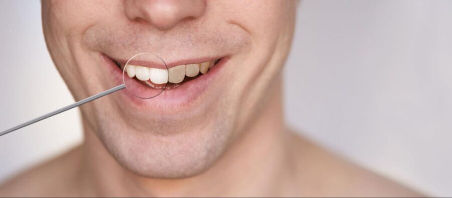 Prosty sposób na idealnie białe zęby