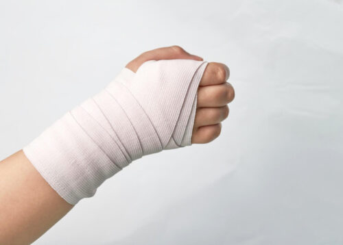 Ile odszkodowania za złamaną rękę w nadgarstku? Sprawdź!
