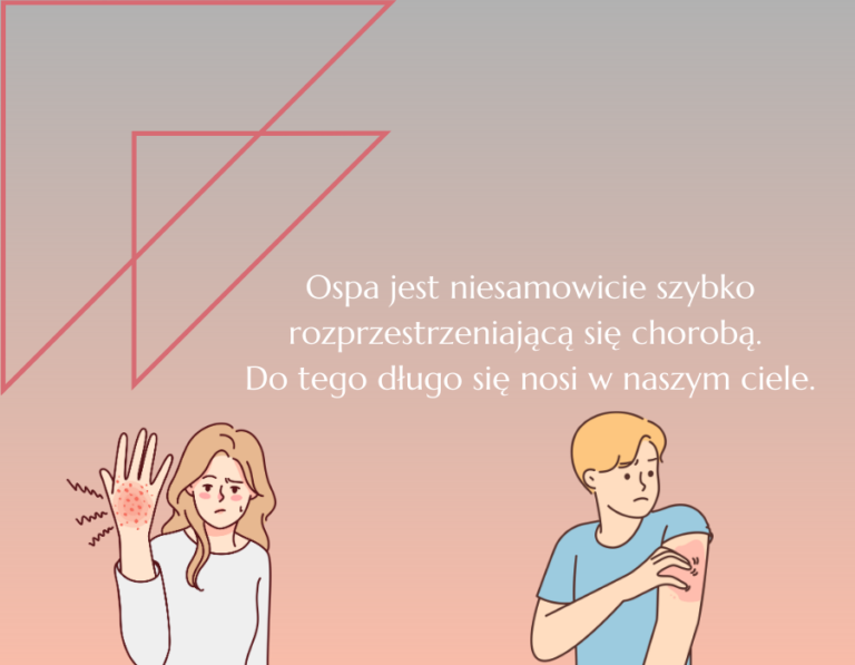 Ospa – jak długo w domu przy ospie wietrznej? • Ratownik Medyczny