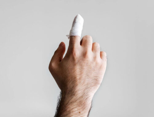 Jak usztywnić złamany palec u ręki? Zrozumieć i działać prawidłowo