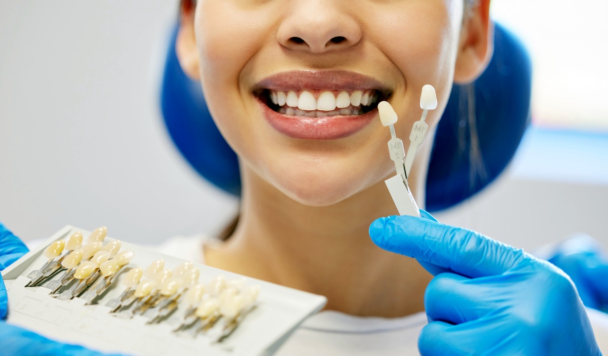 Bonding zębów - wszystko co musisz wiedzieć • Ratownik Medyczny